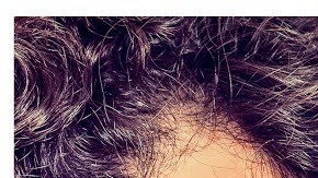 Los transtornos de ansiedad y las depresiones han aumentado este año.