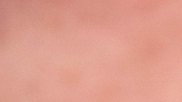 A nurse wearing a face mask injects the vaccine against influenza to a high-risk patient, outdoors to prevent the spread of the coronavirus Covid-19, in Trelleborg, southern Sweden, on November 19, 2020. (Photo by Johan NILSSON / TT NEWS AGENCY / AFP) / Sweden OUT (Photo by JOHAN NILSSON/TT NEWS AGENCY/AFP via Getty Images)