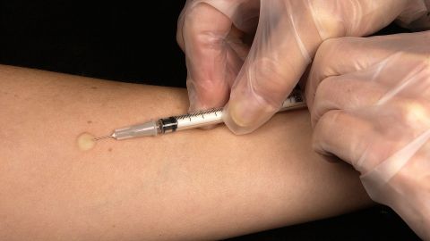 De acuerdo a la Ley de Estadounidenses con Discapacidades, los empleadores pueden exigir a los trabajadores que se sometan a pruebas médicas que estén “relacionadas con el trabajo y que sean compatibles con las necesidades comerciales”, y actualmente eso puede incluir una prueba de Covid-19.