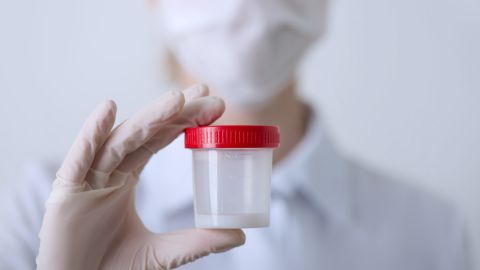 Foto de una persona con una muestra de esperma en la mano