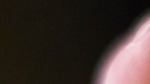 Vacunas contra coronavirus