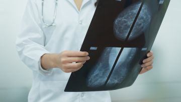 Foto de una doctora consultando radiografías