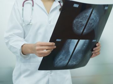 Foto de una doctora consultando radiografías