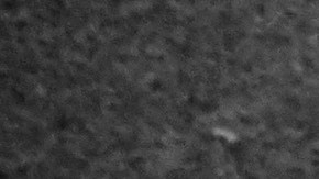 compensacion por accidente de trabajo en eeuu