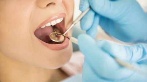 atencion plan dental