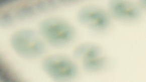 Impuestos del IRS sobre el pago de Minnesota