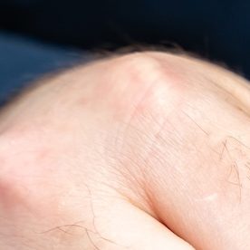 Algunos pagos sujetos a la retención de respaldo son los pagos de intereses, dividendos y alquileres.